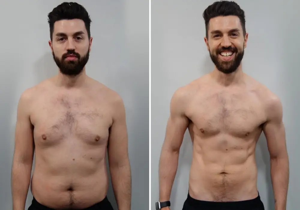 Antes e Depois - Rafael